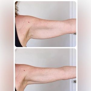 RENU SPA HEALTH WELLNESS CELLULITE IRON